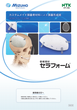 カスタムメイド頭蓋骨材料による頭蓋形成術
