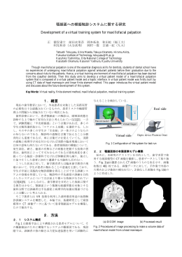 顎顔面への模擬触診システムに関する研究 Development of a virtual