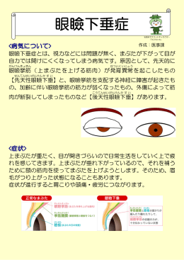 眼瞼下垂症