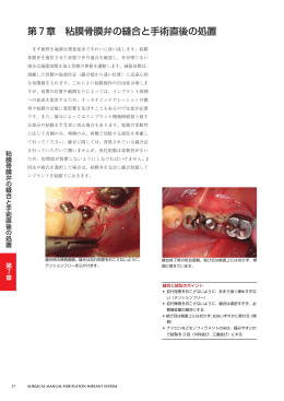 第7章 粘膜骨膜弁の縫合と手術直後の処置