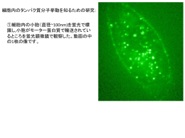 ①細胞内の小胞（直径~100nm)を蛍光で標 識し,小胞がモーター蛋白質