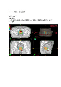 78Gy／39 回 75 歳・男性 PSA 高値のため近医にて前立腺癌指摘