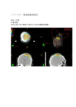 50Gy／10 回 61 歳・男性 セカンドオピニオン希望にて当クリニックがん