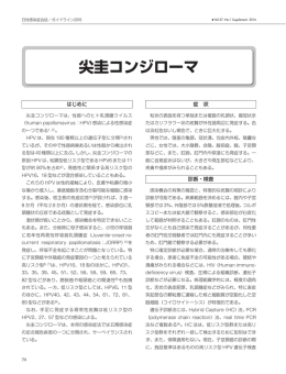 尖圭コンジローマ - 日本性感染症学会