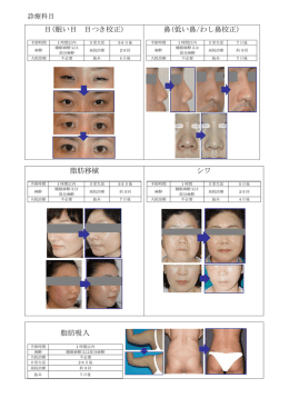 詳細は、こちら