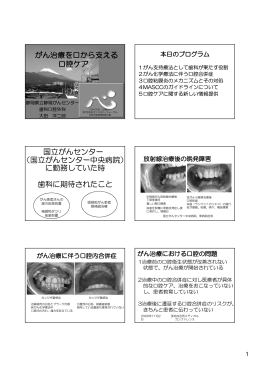 がん治療を口から支える 口腔ケア