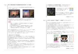 第 4 回東京整形外科画像診断研究会終了のご報告 COPD に有効な CT